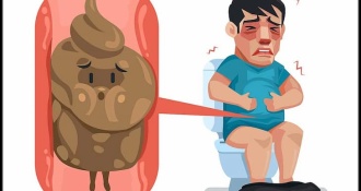 Són phân ở trẻ nhỏ: Đừng chủ quan khi táo bón kéo dài